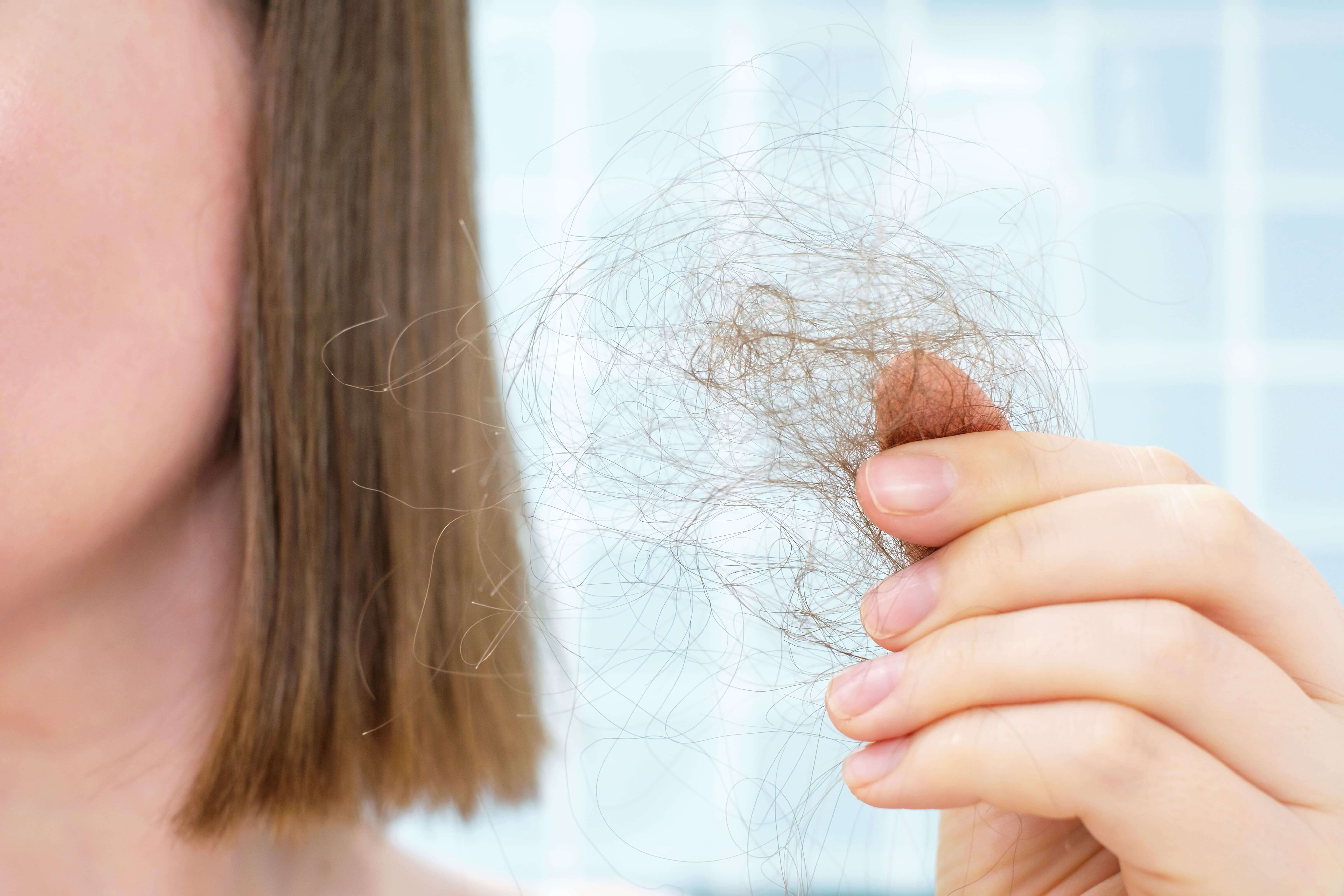 Cómo usar correctamente un tratamiento anticaída y ver resultados reales en 8 semanas